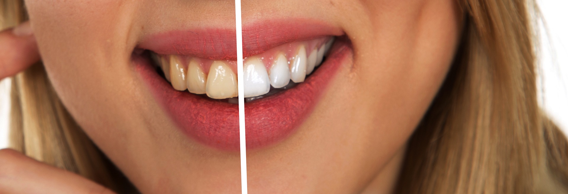 los-mejores-y-peores-alimentos-para-tus-dientes.jpg