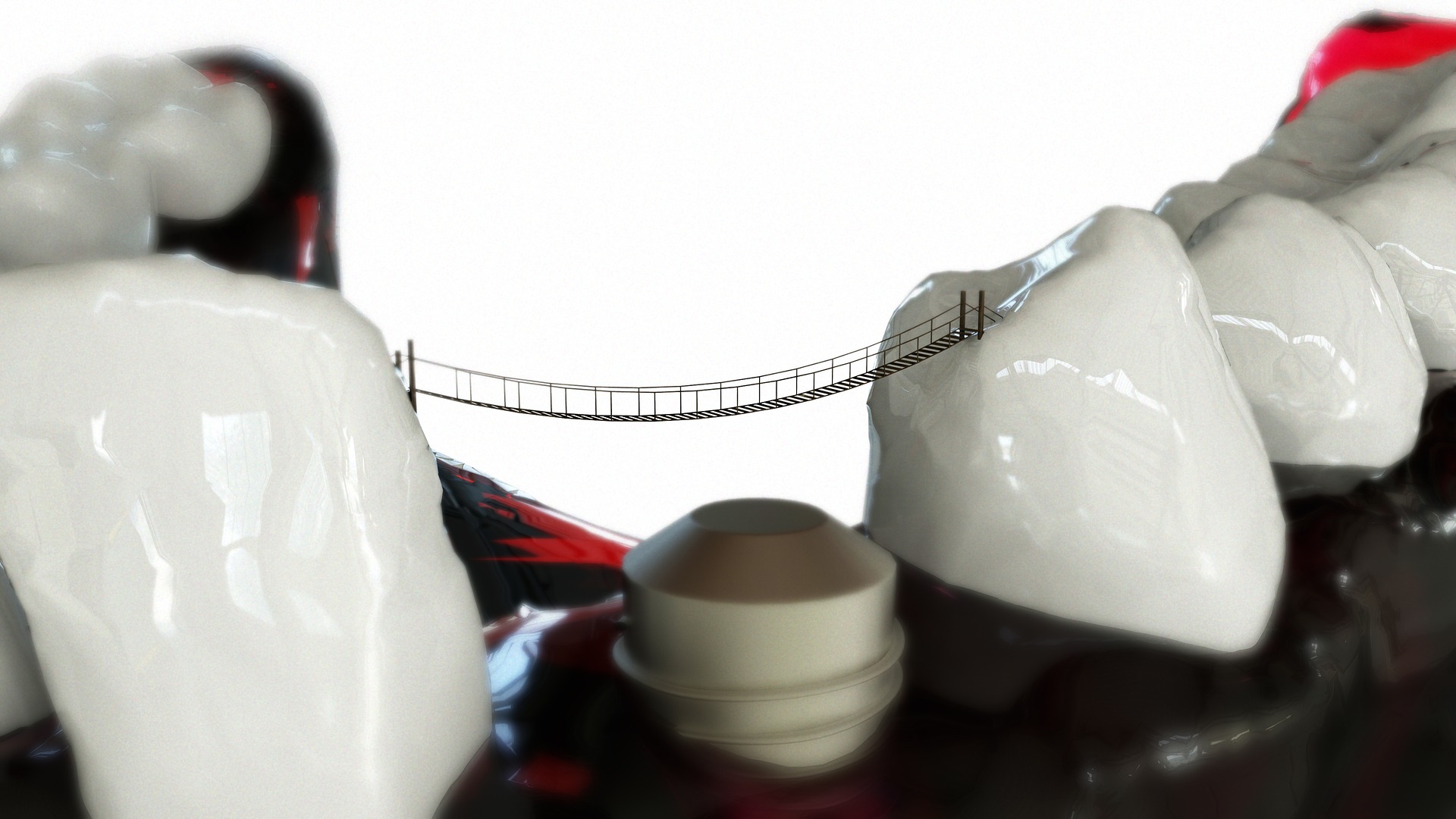 que-son-los-implantes-dentales.jpg